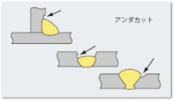 アンダカット